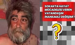 Sokakta hayat mücadelesi veren vatandaşın inanılmaz değişimi !