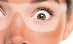 Dermatoloji Uzmanı Uyardı: Güneş Yanığı Deyip Geçmeyin