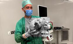 Karın Ağrısıyla Gitti Doktorlar Gördüklerine İnanamadı