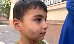 Evde uyuyan çocuğu lağım faresi ısırdı!