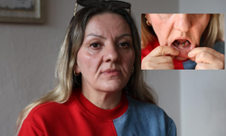 Hızlı Tedavi Vaadi Sivaslı Kadının Hayatını Kararttı!