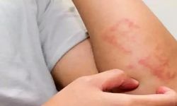 Daha Önce Bu Durumu Yaşayanlar Mutlaka Bildirmeli!