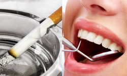 Paranız Çöp Olabilir! Implant Kaybının En Büyük Nedeni Sigara Kullanımı!