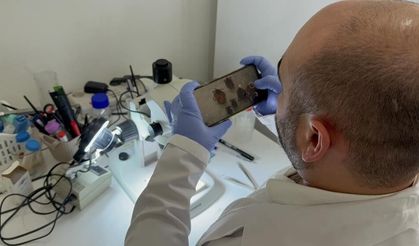 Keneler sadece KKKA değil, yüzlerce hastalığın taşıyıcısı olabilir