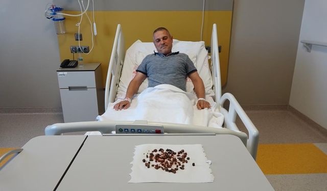 Böbreğinden çıkanlara doktorlar bile şaşırdı!..
