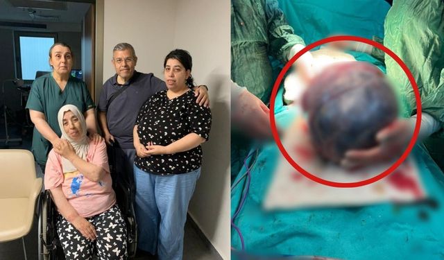 52 yaşındaki kadının karnından 40 santimlik kitle çıktı
