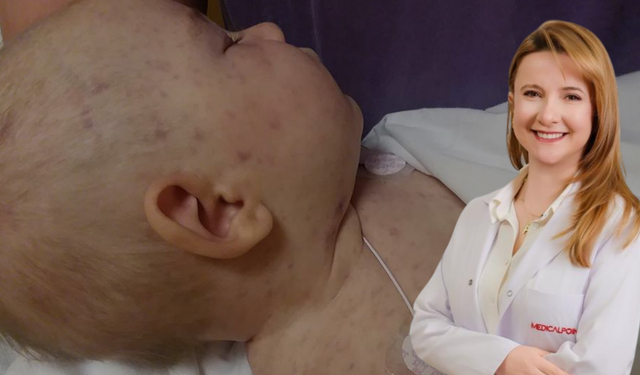 Sıradan Bir Baş Ağrısı Sanmayın! Sessizce Yaklaşan O Tehlike Sakat Bırakabilir!