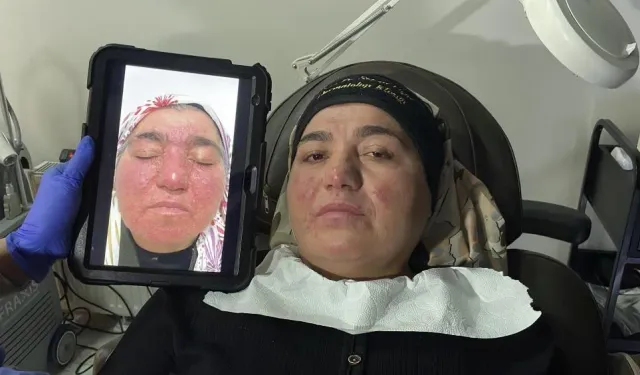 Sivas’ta Tedaviyle 20 Yıl Sonra Hayata Döndü