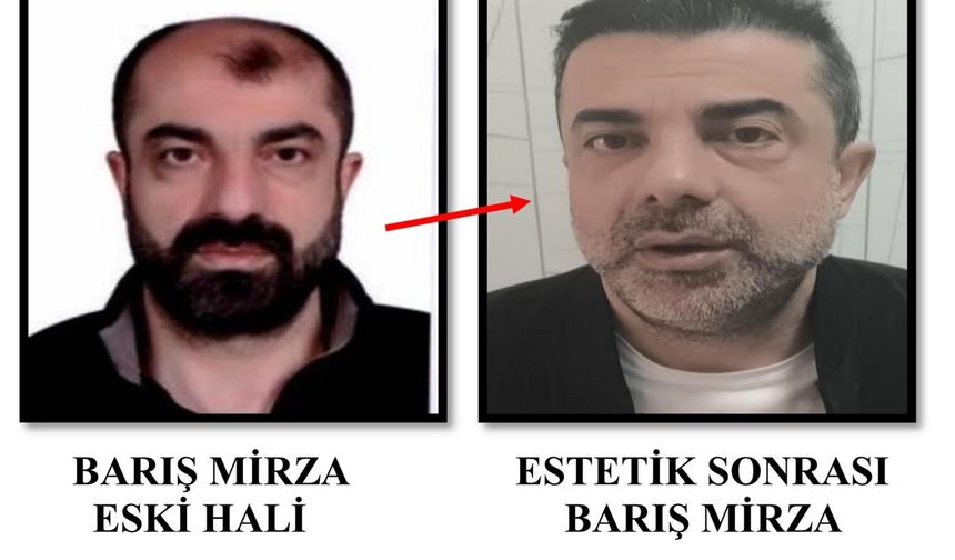 Estetik Operasyonla Kaçış Planı Çöktü