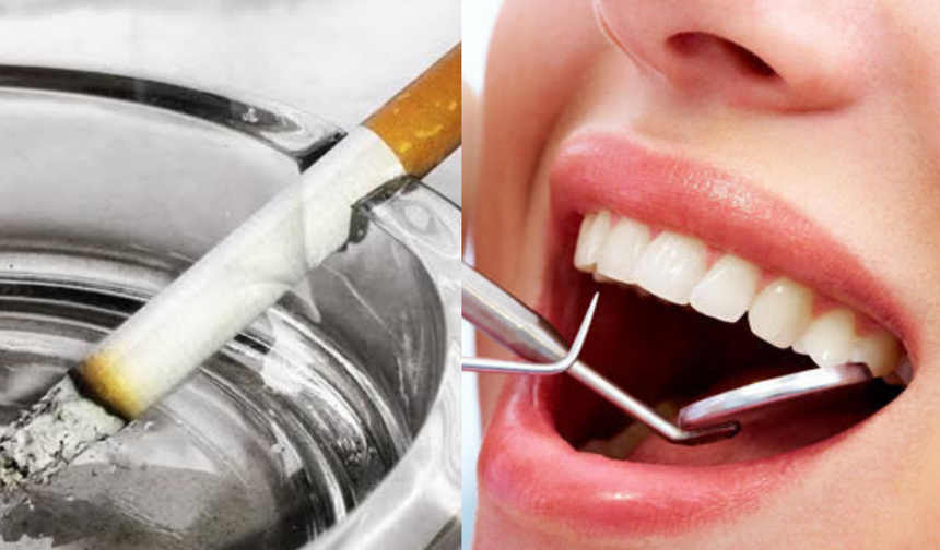 Paranız Çöp Olabilir! Implant Kaybının En Büyük Nedeni Sigara Kullanımı!