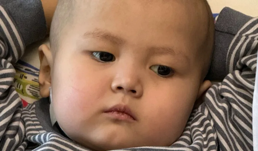 Türk Doktorlardan 3 Yaşındaki Çocuğa Hayat Veren Operasyon